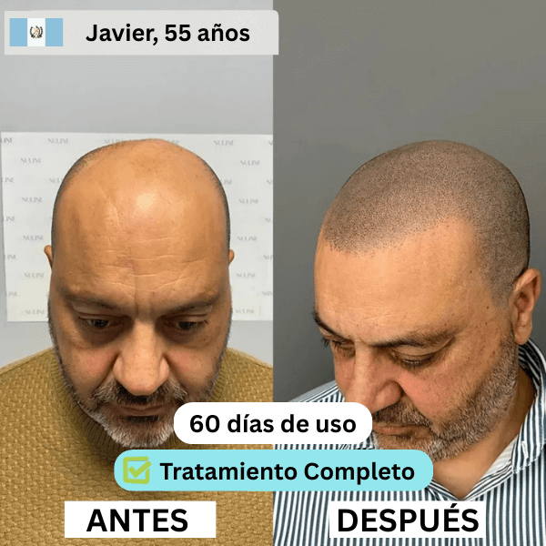 GT-3-copia-2.png