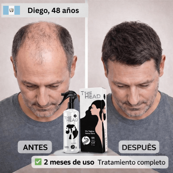 GT-3-copia-3.png