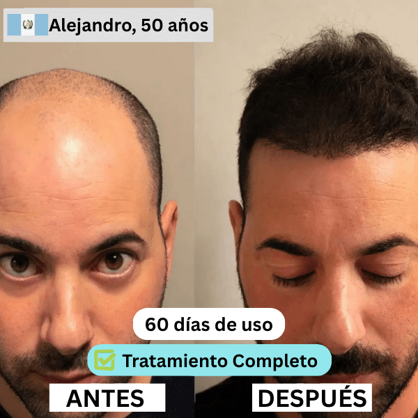 GT-3-copia.png