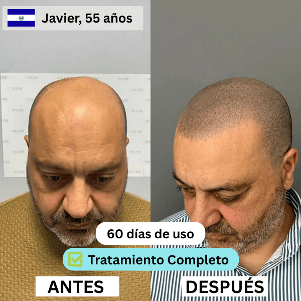 SV4.png